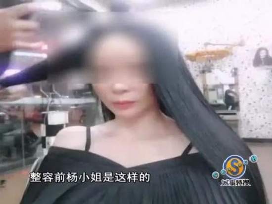 女子花9万整容结果鼻子下巴歪了 院方:你去跳楼啊