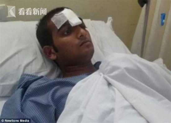 神奇!男子遇车祸被1米铁棍贯穿头部 结果大难不死