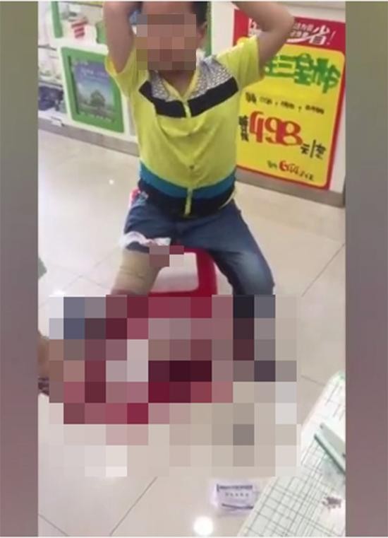 被电梯夹伤的八岁男童，镇定坐在小板凳上。 本文图均为 广西云客户端 视频截图