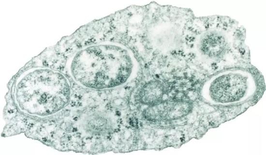 沃尔巴克氏体（图片作者：Scott O Neill，Public Domain）