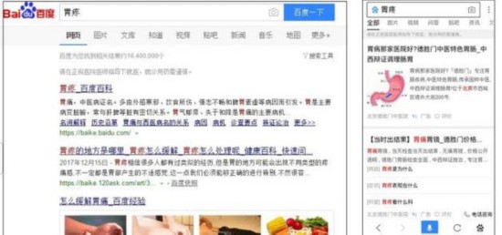 （左右图分别为电脑端和手机端“胃疼”关键词搜索结果）