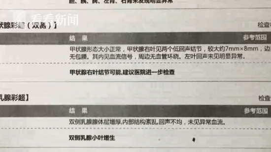 屏幕快照 2018-08-02 下午1.43.46.png