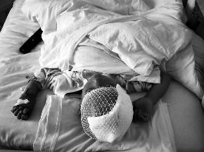 4岁女孩被邻居大狗咬掉头皮 亲属:跑4家医院都不收