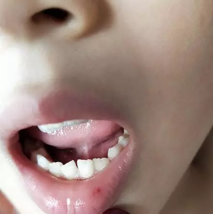 男孩辅导班回家1句话震惊妈妈:今天尝到血的味道了