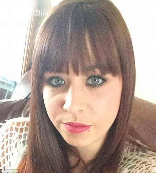 女子救助生病邻居 反遭对方丈夫泼汽油点燃致毁容