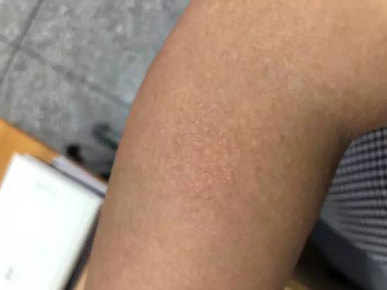 租客中存在普遍的过敏现象