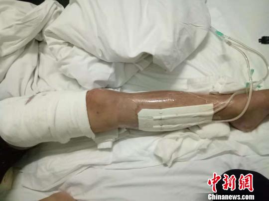 初中生“梦中挥刀”致邻铺同学重伤警方介入调查