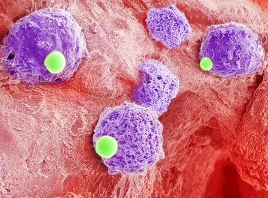 ▲这也是首个将两类不同细胞连接在一起的联合疗法（图片来源：UCLA官网）