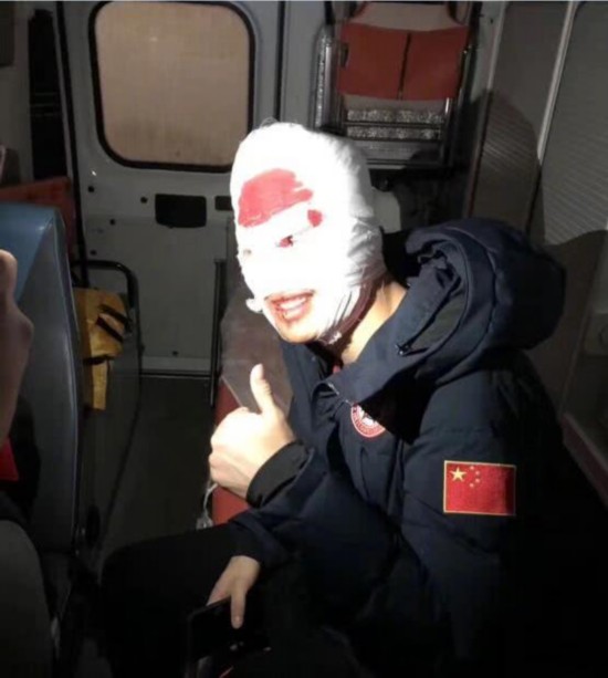 恐怖!曲棍球手被球击中失明 切开脑袋手术满头刀疤_冰球比赛危险事件_冰球选手被冰刀击中缝针案例