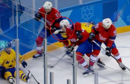 冰球比赛危险事件_冰球选手被冰刀击中缝针案例_恐怖!曲棍球手被球击中失明 切开脑袋手术满头刀疤