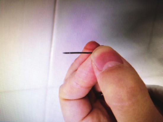 　　小排内吃出的针头。（陈女士供图）