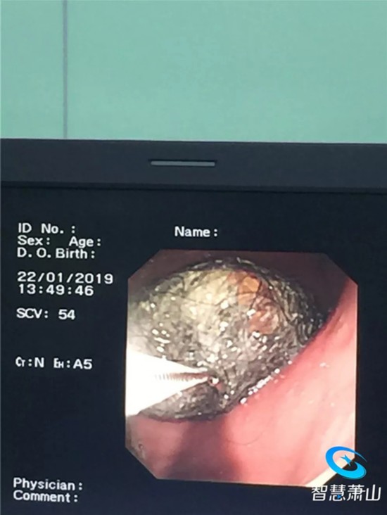  本文图均为 浙江萧山医院健康网微信公众号 图