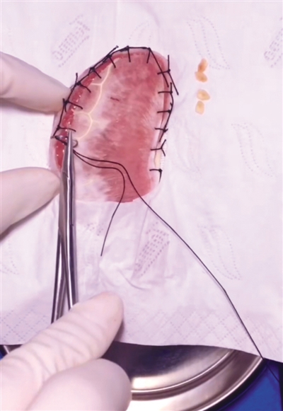 王野虓给水果做&ldquo;手术&rdquo;。 图片/受访者供图