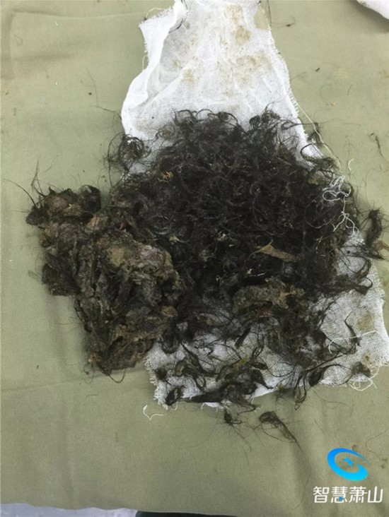 晨晨术后恢复良好,目前已经出院。