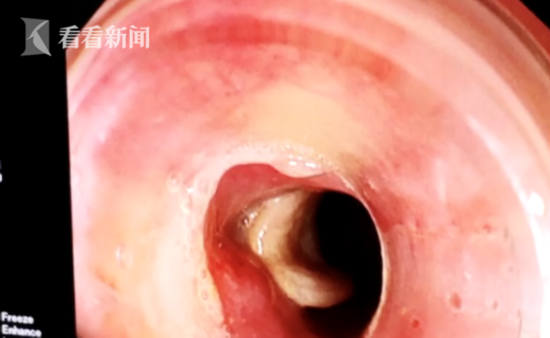 屏幕快照 2019-05-03 下午4.47.58.png