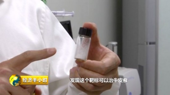  王云兵研发的血管支架