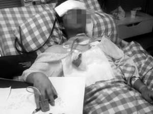 小江气管受了重伤。