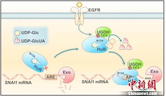 中国科学家发现抑制肺癌转移的代谢小分子