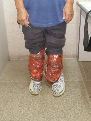 涉案人将未经检疫食材缠于小腿逃避海关检查。图片来源：澳门特区政府网站