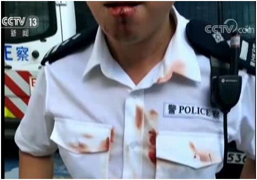 门牙被暴徒用钢珠打到碎成四块的警官黄家伦