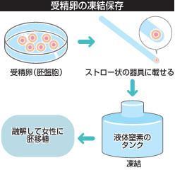 受精卵冻胚保存过程（京都新闻）