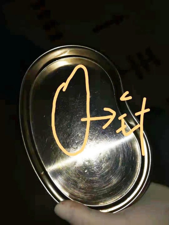 老太喉部咋有根根针 原是老人脑梗发作自己戳的