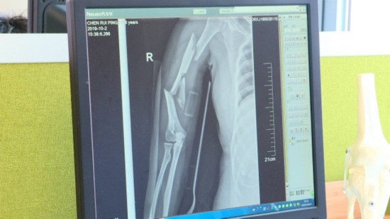 心疼！母女回家途中突遭车祸，医疗费用成负担