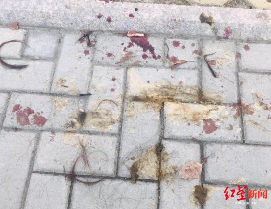 &uarr;事发地上的血迹和头发