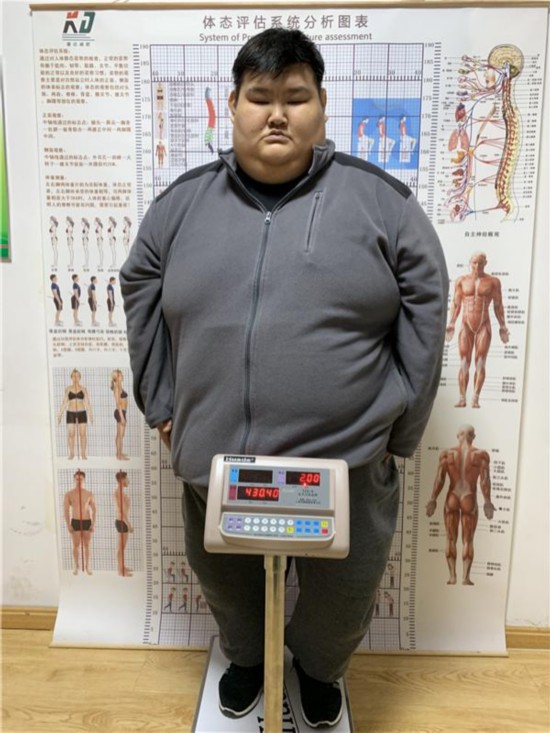 【430斤小伙10天瘦30斤 曾尝试放血减肥晕倒住院】瘦小伙变胖