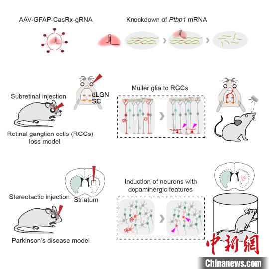 中国科研人员新研究为治疗青光眼、帕金森疾病等&ldquo;探路&rdquo;