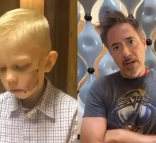 超级英雄|6岁男孩护妹与恶狗搏斗受伤被缝90针,WBC授其“荣誉拳王”称号