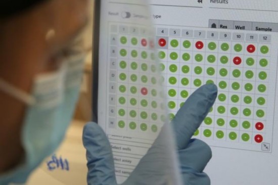 疑似病例|英媒：研究发现英国疑似新冠病例数为官方确诊数量三倍