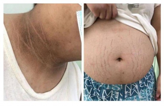 比中年发福危害更大的儿童肥胖，家长千万要重视！