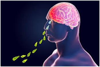 北移趋势|可怕！美疾控中心警告：“食脑虫”正“进军”美国并向北迁徙