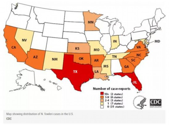 北移趋势|可怕！美疾控中心警告：“食脑虫”正“进军”美国并向北迁徙