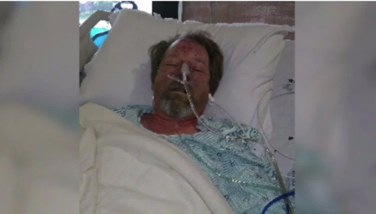 宠物死亡之吻:男子被狗舔引感染 四肢鼻子被切除