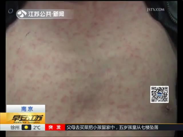 小诊所就医起纠纷 男子看病不成疑似过敏