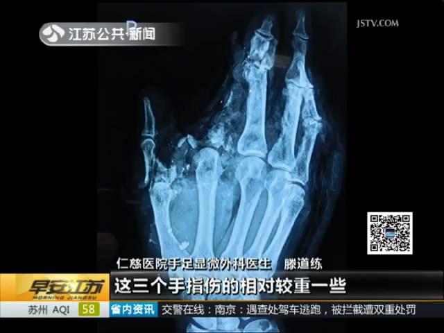 地里刨出手榴弹  男子不幸被炸伤