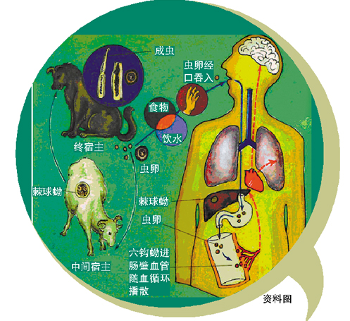 包虫病感染途径