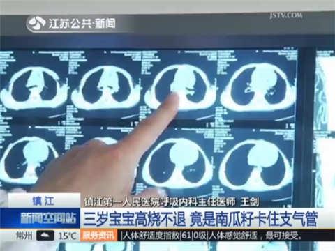 南瓜籽卡住支气管 三岁宝宝高烧不退