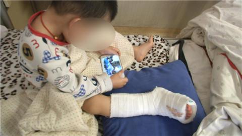 南京3岁男孩被卡电扶梯 右脚骨折皮肤坏死