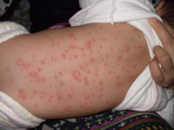 短暂降温后徐州将迎来34高温凉席放久了养百万螨虫教你一招彻底清除