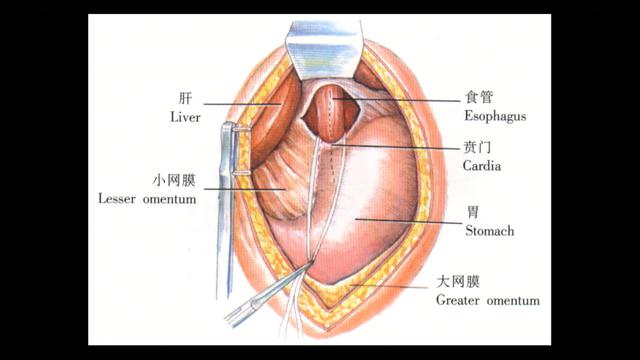 1岁男童被确诊贲门失驰缓症