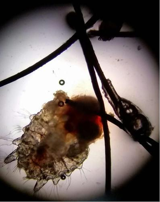 显微镜下的阴虱图片