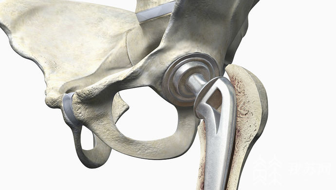 又一批医用耗材组团砍价 江苏高值医用耗材联盟带量采